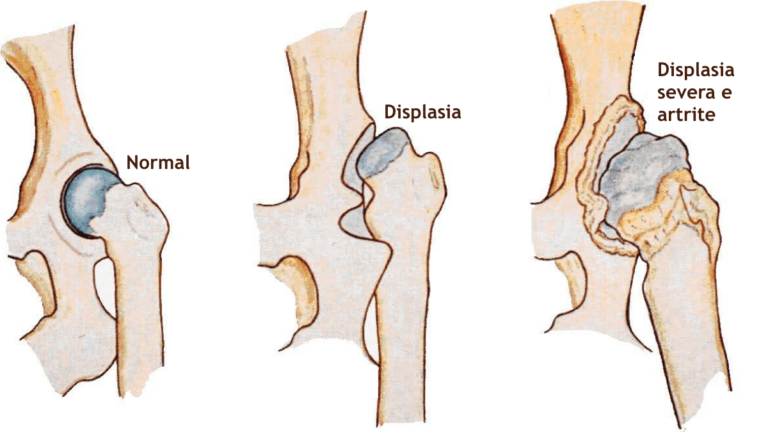 Displasia Coxofemoral